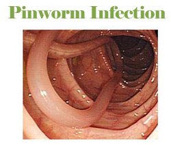 Can you die from a pinworm infection?
